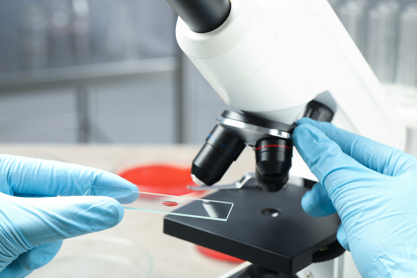 Scientist Examining Sample of Red Liquid on Slide under Microscope in Laboratory, Closeup